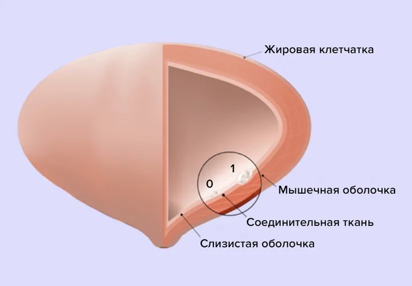 Расстройства мочеиспускания