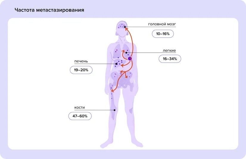 Chastota_metastazirovaniia.width-826.format-webp