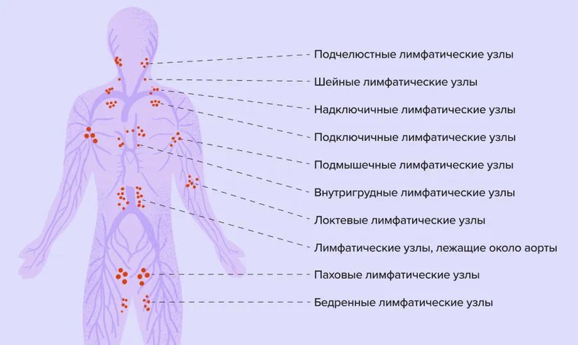 Лимфаденит (воспаление лимфоузлов)