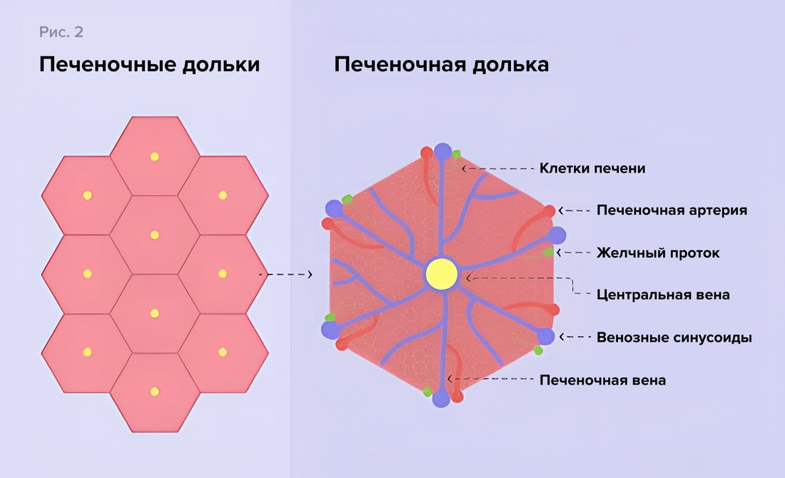 Рис_2_Как_меняется_печень_при_циррозе