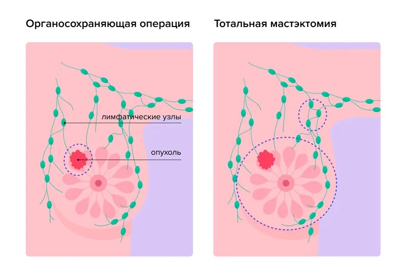 operatsii_rmzh.width-826.format-webp