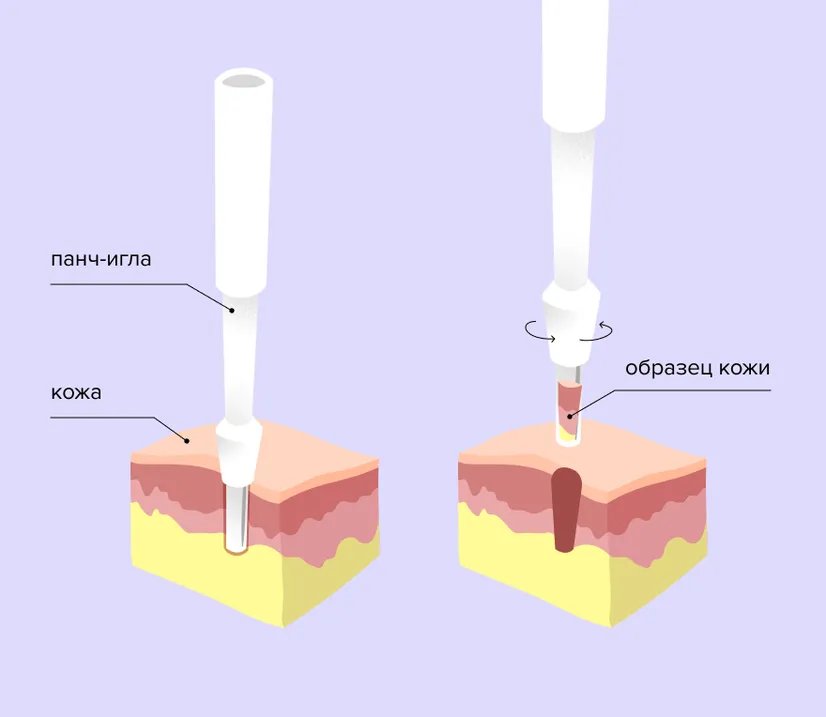 ris_2_biopsiia_Jz2w6DM.width-826.format-webp